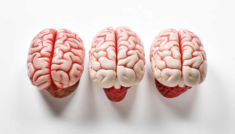 Gehirn Demenz und Alzheimer